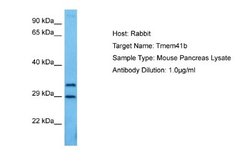 TMEM41B Rabbit anti-Mouse, Polyclonal, Novus Biologicals 0.1 mL | Buy Online | Novus Biologicals | Fisher Scientific